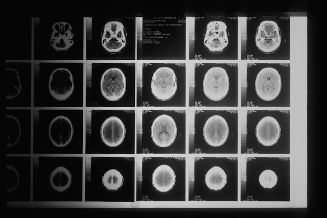 Style narratif : un levier magique pour la mémoire et la perception des récits